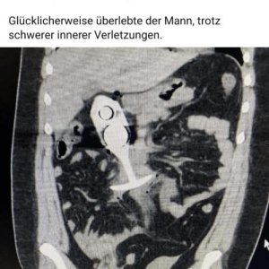 Grund für Goochers fotzigkeit gefunden